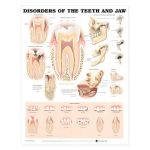Teeth Jaw Chart - Disorders of the Teeth and Jaw