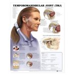 TMJ Temporomandibular Joint Chart Jaw Syndrome