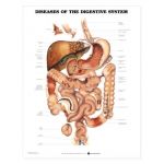 Digestive System Chart - Diseases of the Digestive System