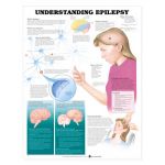 Epilepsy Chart - Understanding Epilepsy