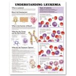 Leukemia Chart - Understanding Leukemia