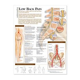 Spine Chart - Understanding Low Back Pain