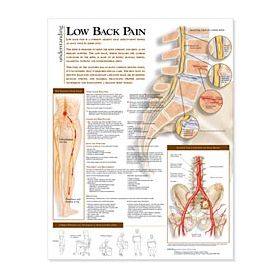 Spine Chart - Understanding Low Back Pain Spine Chart - Understanding Low Back Pain