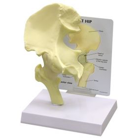 Hip Anatomical Model