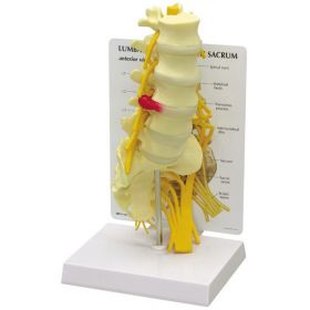 Vertebrae Scarum 5-pc Anatomical Model