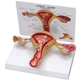 Uterus Ovary Anatomical Model