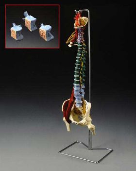Spine Anatomical Model w Muscle Disorders