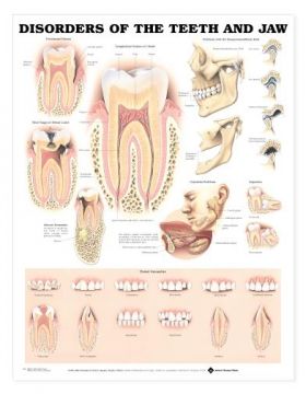 Teeth Jaw Chart - Disorders of the Teeth and Jaw