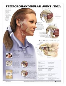 TMJ Temporomandibular Joint Chart Jaw Syndrome
