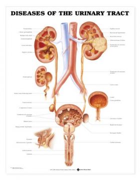Urinary Tract Chart - Diseases of the Urinary Tract