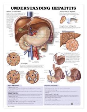 Hepatitis Chart - Understanding Hepatitis