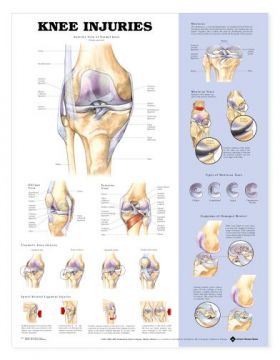Knee Chart - Knee Injuries Knee Chart - Knee Injuries