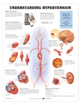 Hypertension Chart - Understanding Hypertension Hypertension Chart - Understanding Hypertension