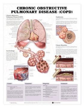 COPD Chronic Obstructive Pulmonary Disease Chart