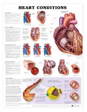 Heart Conditions Chart - Heart Conditions