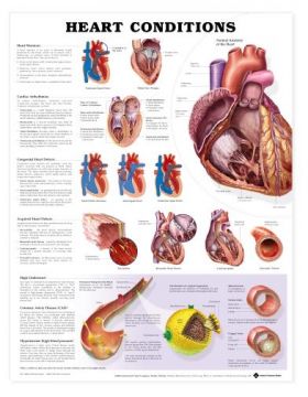 Heart Conditions Chart - Heart Conditions Heart Conditions Chart - Heart Conditions