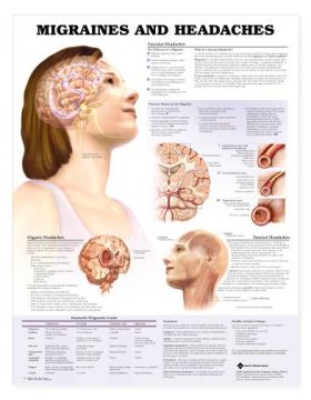 Migraines and Headaches Laminated Chart LFA # 99979 *