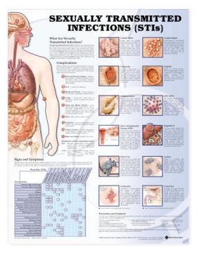 STI Sexually Transmitted Chart - Sexually Transmitted Infections (STI) STI Sexually Transmitted Chart - Sexually Transmitted Infections (STI)