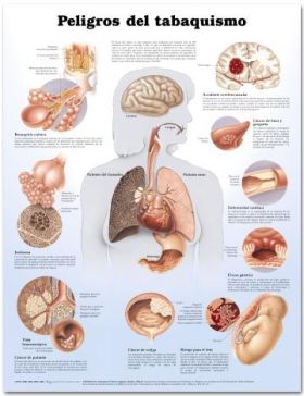 Smoking Chart - Dangers of Smoking   Spanish Language