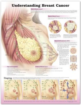Breast Cancer Chart - Understanding Breast Cancer
