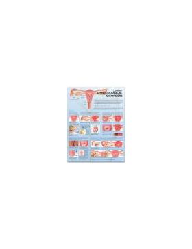 Gynecological Chart - Common Gynecological Disorders Gynecological Chart - Common Gynecological Disorders