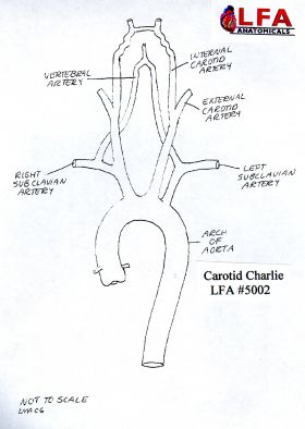 Carotid Charlie Professional Interventional Cardiology Training Model