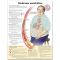 Metabolic Syndrome Chart SPANISH LANGUAGE