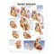 Heart Disease Chart - Heart Disease