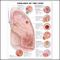 Lung Chart - Diseases of the Lung