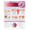 Infertility Chart